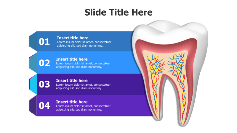 4-Step Tooth Infographic