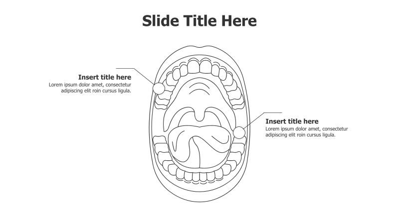 Opened Mouth Infographic with Two Callouts